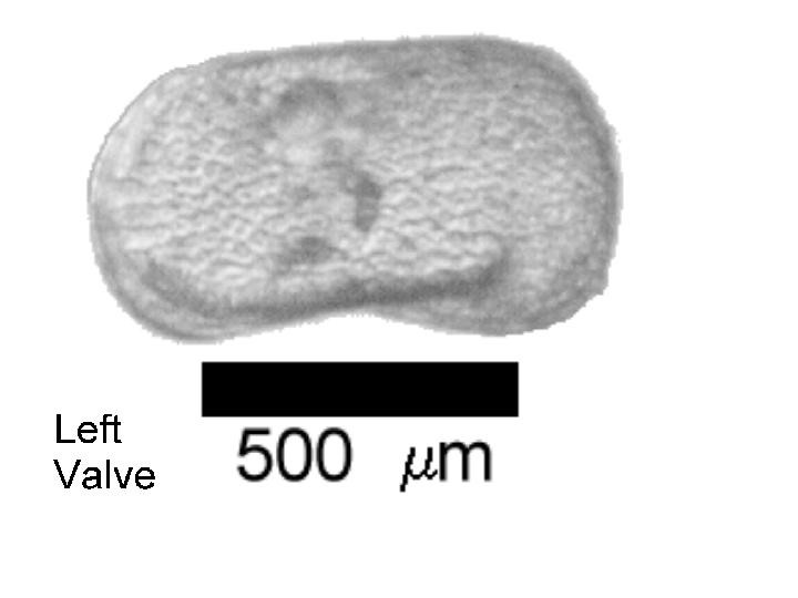 Microscope photograph of Linop, left valve