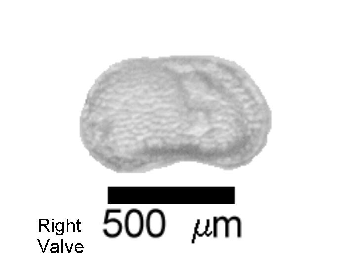 Microscope photograph of Linop, right valve