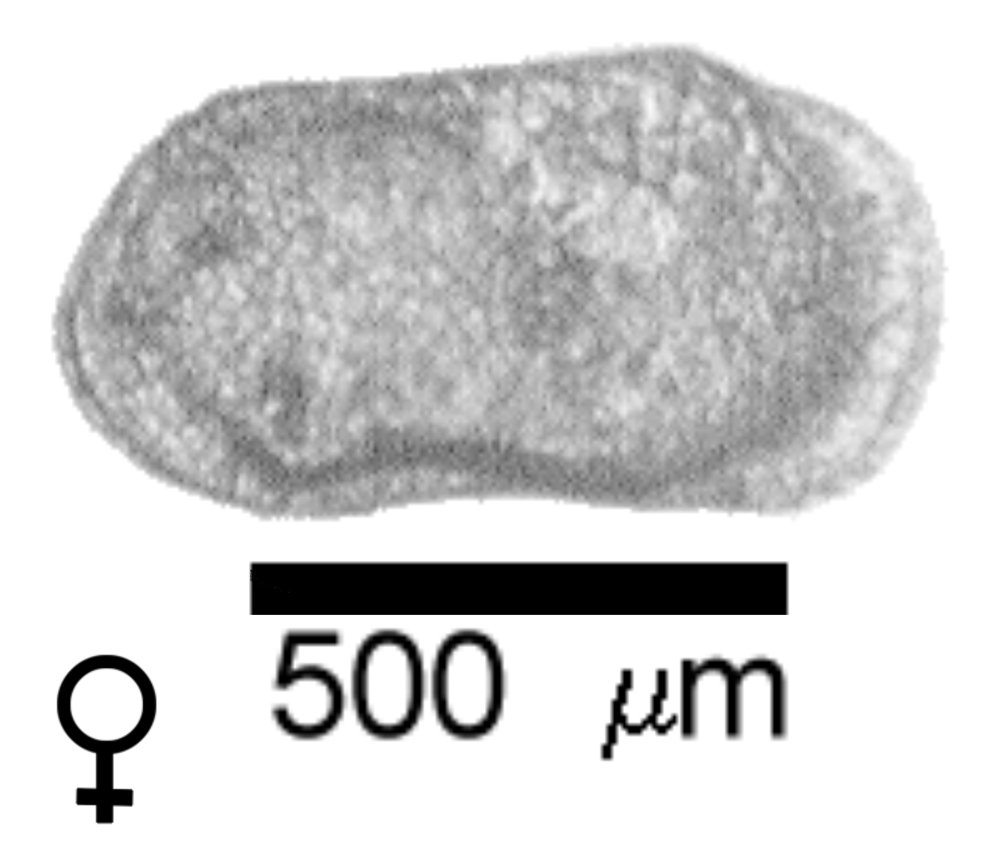 Microscope photograph of Lverr, female
