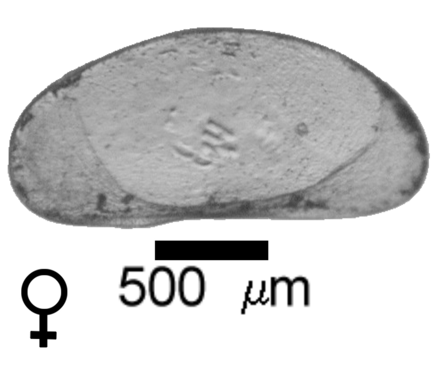 Microscope photograph of PRIONcanad, female