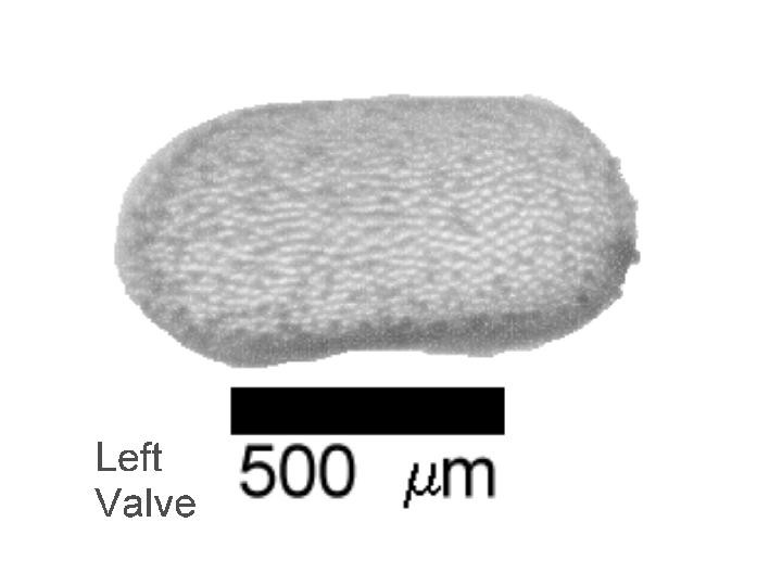 Microscope photograph of Paraeup, left valve