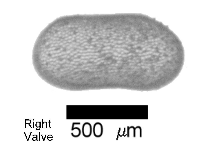 Microscope photograph of Paraeup, right valve