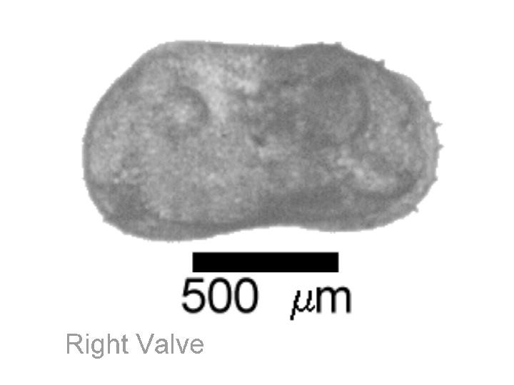 Microscope photograph of Pelala, right valve