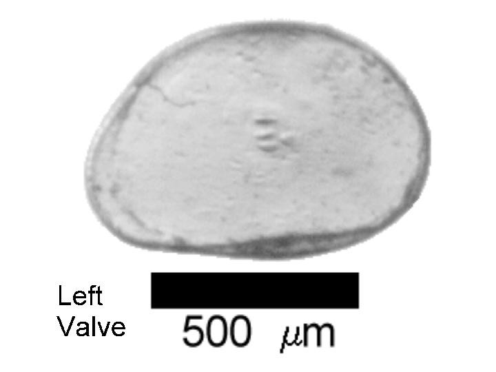 Microscope photograph of Pglob, left valve