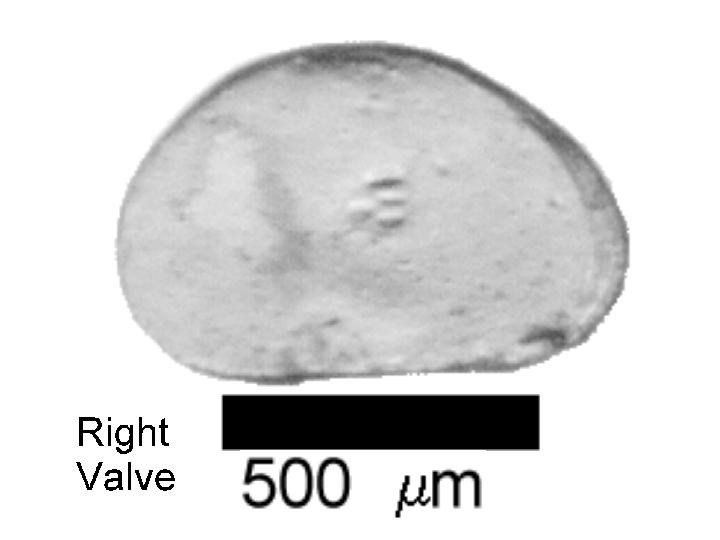 Microscope photograph of Pglob, right valve