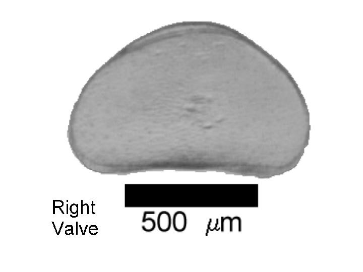 Microscope photograph of Potuni, right valve