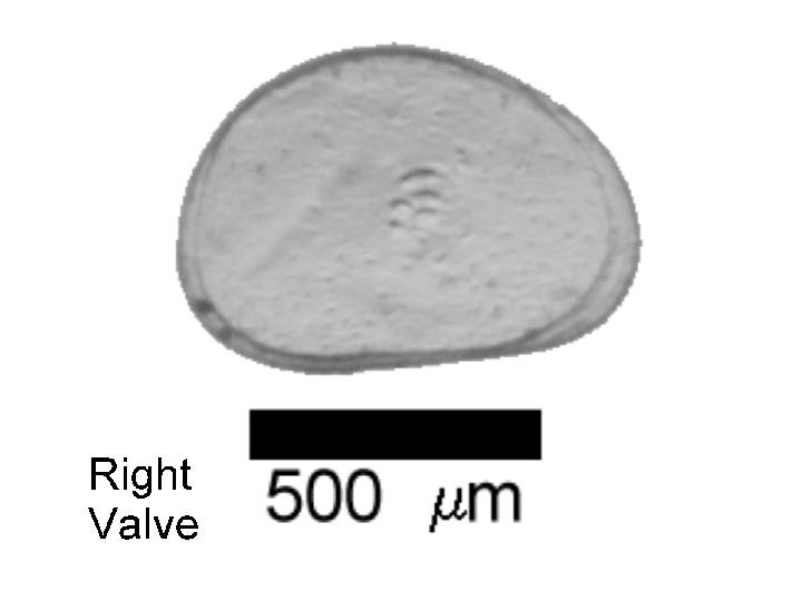 Microscope photograph of Ppust, right valve