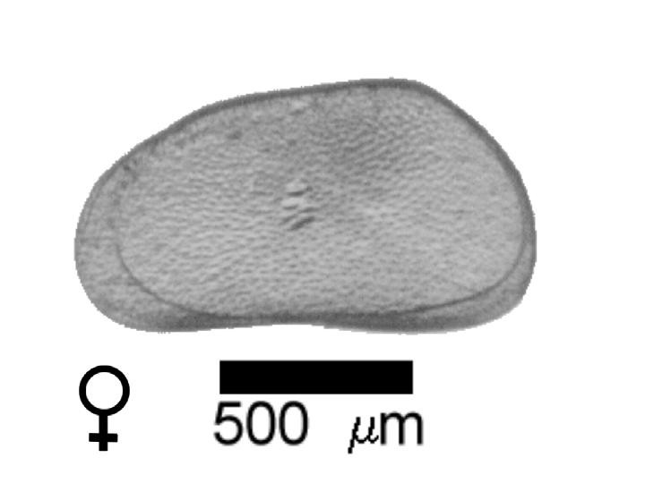 Microscope photograph of Pseudalbi, female