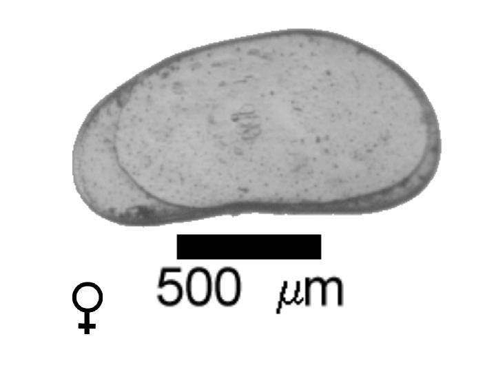 Microscope photograph of Pseudantil, female