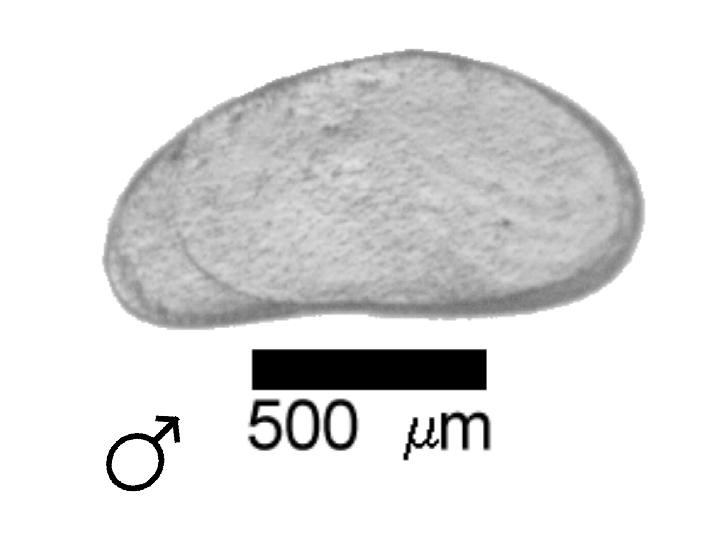 Microscope photograph of Pseudantil, male