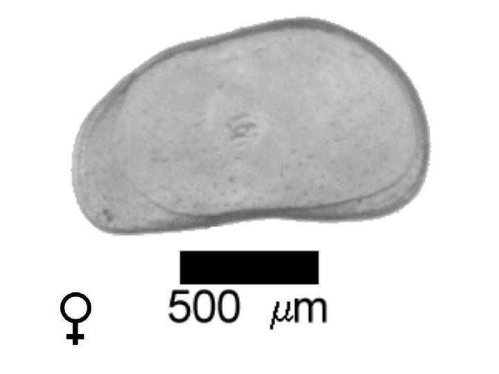 Microscope photograph of Pseudstag, female
