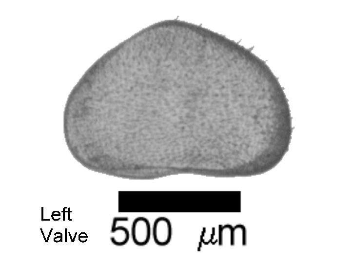 Microscope photograph of Sarsacul, left valve