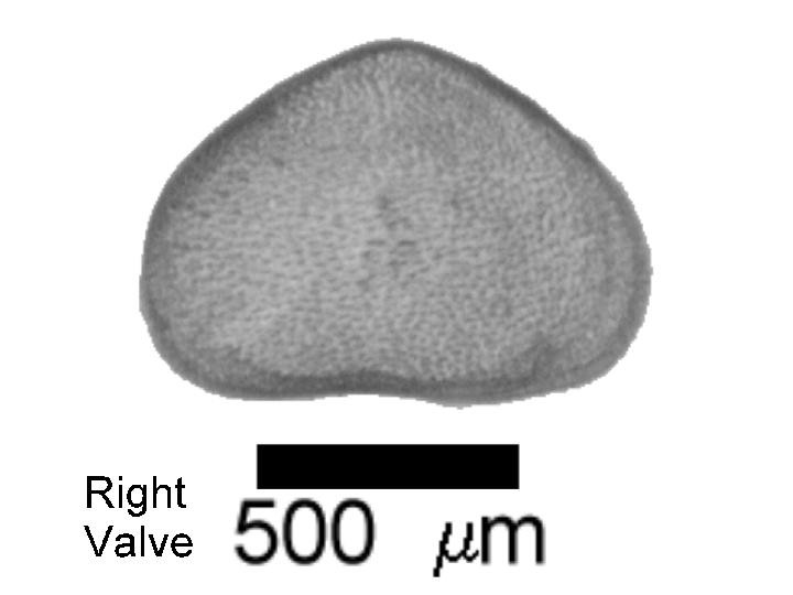 Microscope photograph of Sarsacul, right valve