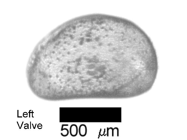 Microscope photograph of Scotpseudb, left valve