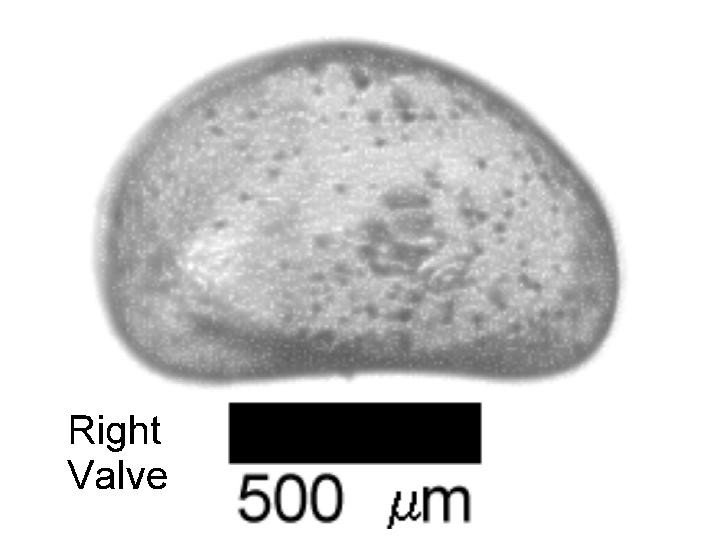 Microscope photograph of Scotpseudb, right valve