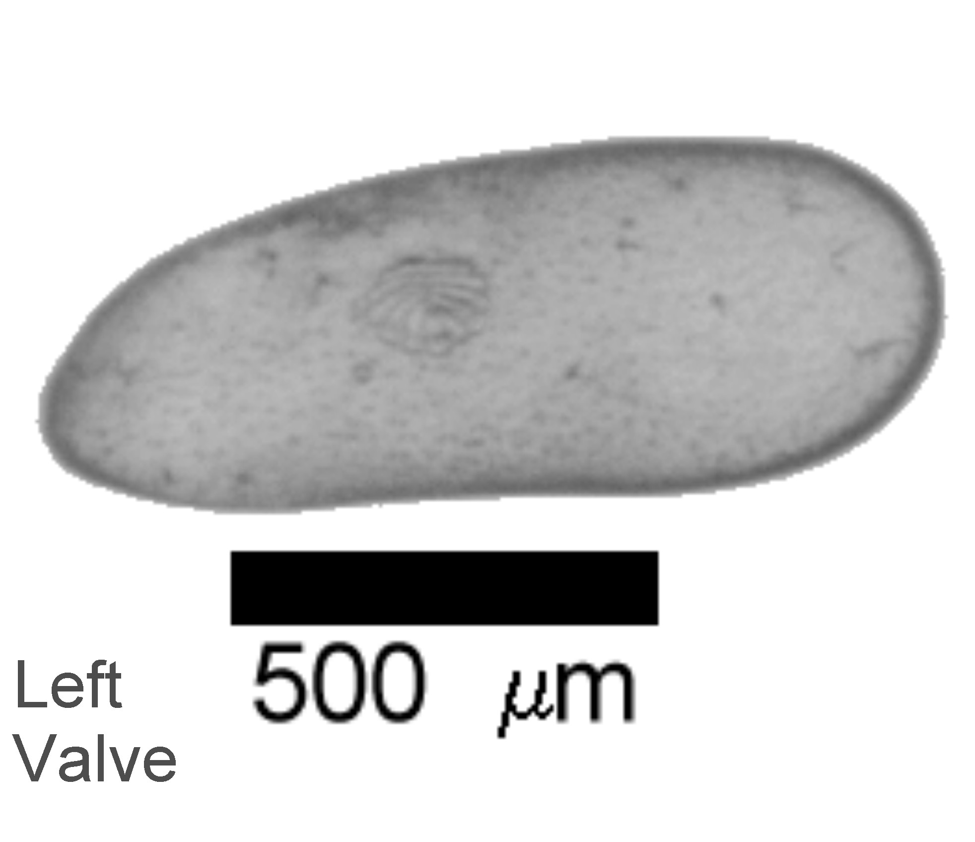 Microscope photograph of darste, left valve