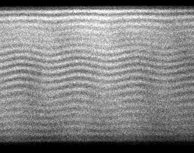 undulations under FCPM